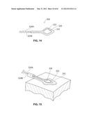 SYSTEMS AND METHODS FOR TREATMENT OF SLEEP APNEA diagram and image