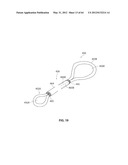 SYSTEMS AND METHODS FOR TREATMENT OF SLEEP APNEA diagram and image