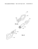 SYSTEMS AND METHODS FOR TREATMENT OF SLEEP APNEA diagram and image