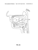 SYSTEMS AND METHODS FOR TREATMENT OF SLEEP APNEA diagram and image