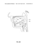 SYSTEMS AND METHODS FOR TREATMENT OF SLEEP APNEA diagram and image