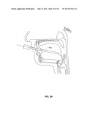 SYSTEMS AND METHODS FOR TREATMENT OF SLEEP APNEA diagram and image