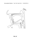 SYSTEMS AND METHODS FOR TREATMENT OF SLEEP APNEA diagram and image