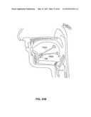 SYSTEMS AND METHODS FOR TREATMENT OF SLEEP APNEA diagram and image