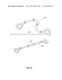 SYSTEMS AND METHODS FOR TREATMENT OF SLEEP APNEA diagram and image