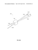 SYSTEMS AND METHODS FOR TREATMENT OF SLEEP APNEA diagram and image