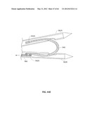 SYSTEMS AND METHODS FOR TREATMENT OF SLEEP APNEA diagram and image