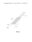 SYSTEMS AND METHODS FOR TREATMENT OF SLEEP APNEA diagram and image