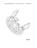 CORNER ASSEMBLY FOR VEHICLE diagram and image