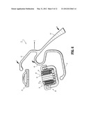 Jaw Restraint diagram and image