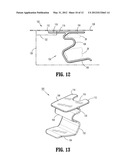 Jaw Restraint diagram and image