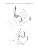 Jaw Restraint diagram and image