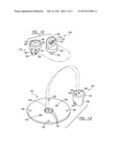 MOUNT WITH IMPROVED JOINT CONNECTION diagram and image