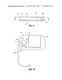 Table Edge Supporting Apparatus diagram and image