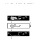 VOLUME-OF-INTEREST SEGMENTATION SYSTEM FOR USE WITH MOLECULAR IMAGING     QUANTIZATION diagram and image