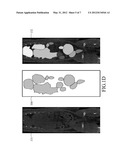 VOLUME-OF-INTEREST SEGMENTATION SYSTEM FOR USE WITH MOLECULAR IMAGING     QUANTIZATION diagram and image