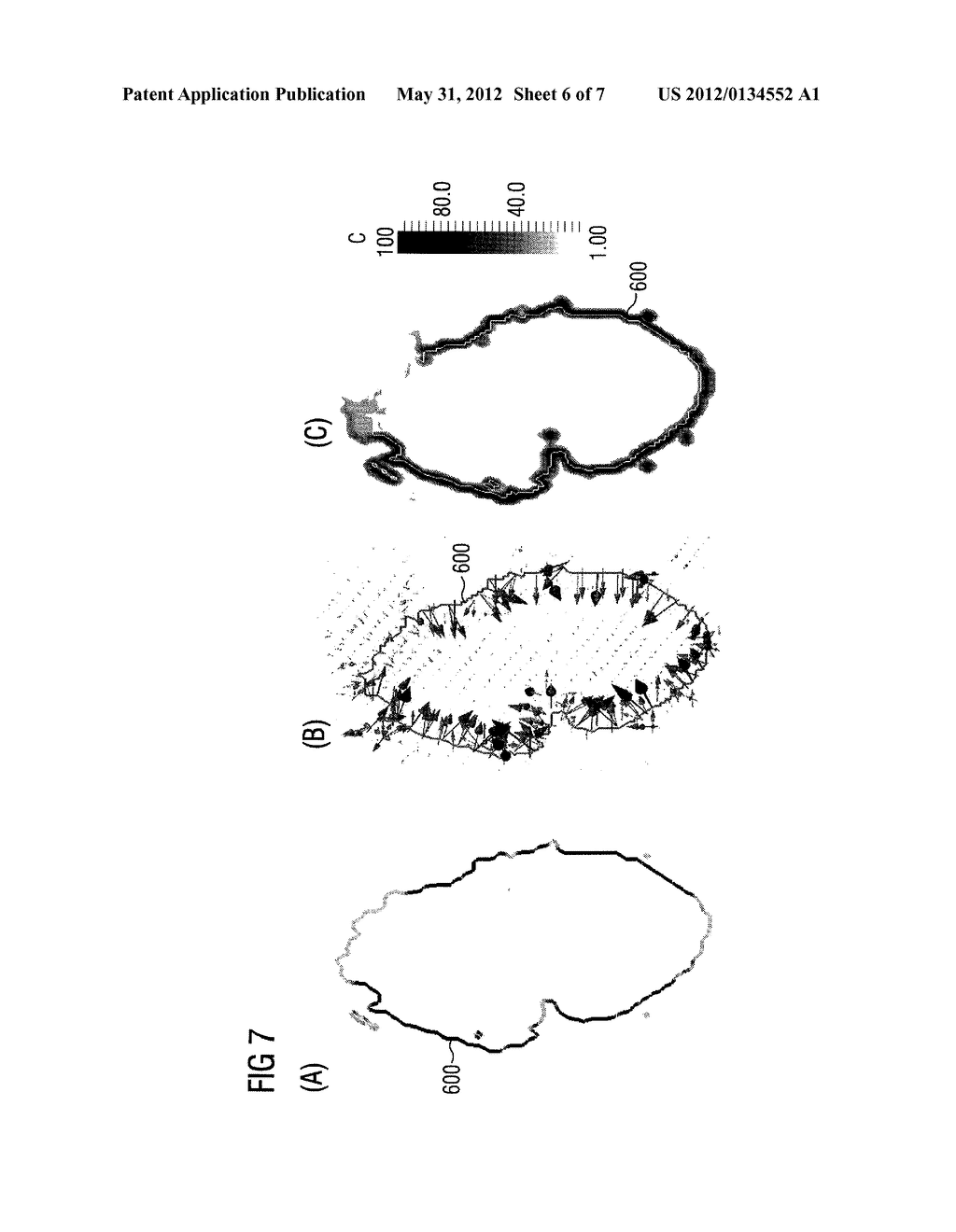 METHOD FOR CHECKING THE SEGMENTATION OF A STRUCTURE IN IMAGE DATA - diagram, schematic, and image 07