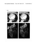 Method and System for Heart Isolation in Cardiac Computed Tomography     Volumes for Patients with Coronary Artery Bypasses diagram and image