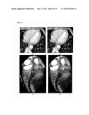 Method and System for Heart Isolation in Cardiac Computed Tomography     Volumes for Patients with Coronary Artery Bypasses diagram and image