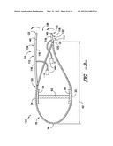 BLADE EXTENSION FOR ROTOR BLADE IN WIND TURBINE diagram and image