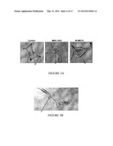 A3 ADENOSINE RECEPTOR LIGANDS FOR MODULATION OF PIGMENTATION diagram and image