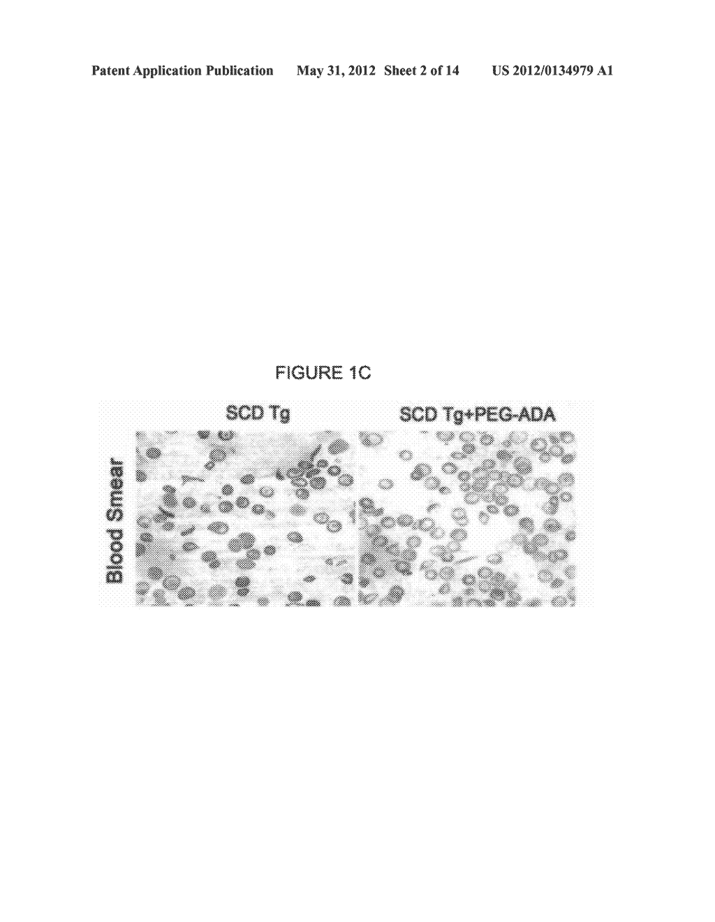 METHODS AND COMPOSITIONS FOR THE TREATMENT OF SICKLE CELL DISEASE - diagram, schematic, and image 03