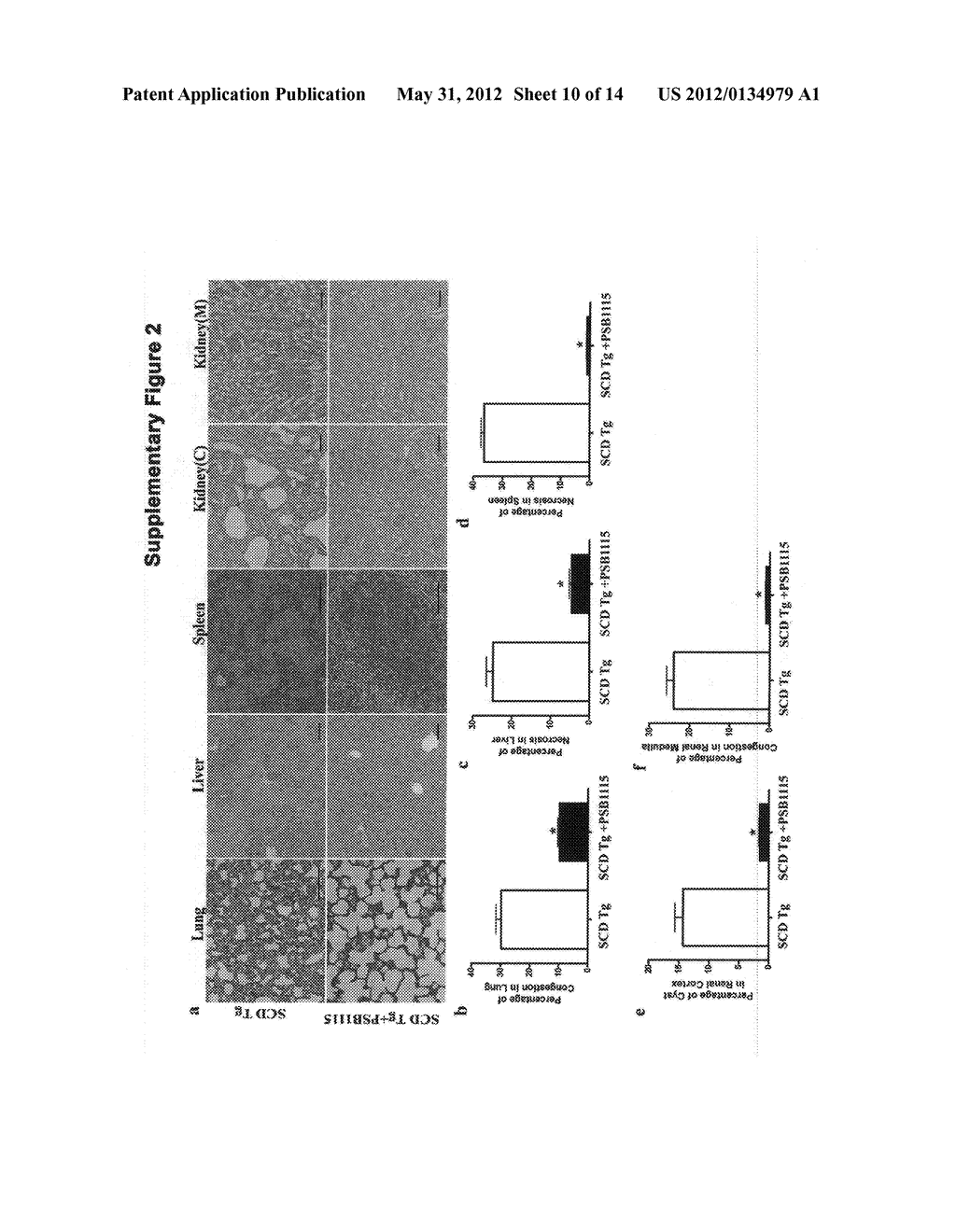 METHODS AND COMPOSITIONS FOR THE TREATMENT OF SICKLE CELL DISEASE - diagram, schematic, and image 11