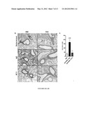 Method for in vivo expansion of T regulatory cells diagram and image