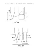 Modified-ouput fiber optic tips diagram and image