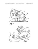 Manufacturing Method Of A Guiding Template For Dental Implantology,     Guiding Template Manufactured Thereby And Reference Device For The     Execution Of Such Method diagram and image