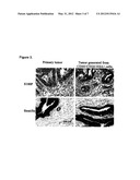 Compositions And Methods For Treating And Diagnosing Pancreatic Cancer diagram and image