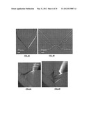 CELL HANDLING, ELECTROPORATION AND ELECTROFUSION IN MICROFLUIDIC SYSTEMS diagram and image