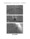 CELL HANDLING, ELECTROPORATION AND ELECTROFUSION IN MICROFLUIDIC SYSTEMS diagram and image