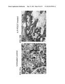 METHODS OF CORRECTING IMBALANCE BETWEEN BONE RESORPTION AND BONE FORMATION     AND KITS AND COMPOSITIONS THEREFOR diagram and image