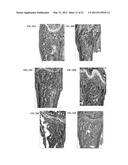 METHODS OF CORRECTING IMBALANCE BETWEEN BONE RESORPTION AND BONE FORMATION     AND KITS AND COMPOSITIONS THEREFOR diagram and image