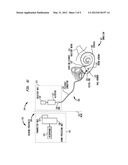 HEARING PROSTHESIS HAVING A FLEXIBLE ELONGATE ENERGY TRANSFER MECHANISM diagram and image