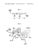 HEARING PROSTHESIS HAVING A FLEXIBLE ELONGATE ENERGY TRANSFER MECHANISM diagram and image