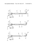 Endoscopic Methods and Devices for Transnasal Procedures diagram and image