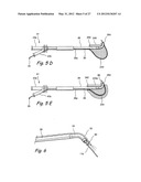 Endoscopic Methods and Devices for Transnasal Procedures diagram and image