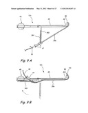 Endoscopic Methods and Devices for Transnasal Procedures diagram and image