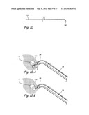 Endoscopic Methods and Devices for Transnasal Procedures diagram and image