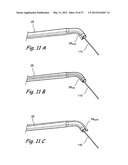 Endoscopic Methods and Devices for Transnasal Procedures diagram and image