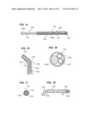 Endoscopic Methods and Devices for Transnasal Procedures diagram and image