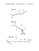 Endoscopic Methods and Devices for Transnasal Procedures diagram and image