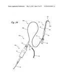 Endoscopic Methods and Devices for Transnasal Procedures diagram and image