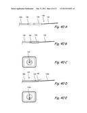 Endoscopic Methods and Devices for Transnasal Procedures diagram and image