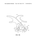 METHOD AND DEVICE FOR QUICK PRESS ON EEG ELECTRODE diagram and image