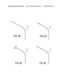 Methods of Transvascular Retrograde Access Placement and Devices for     Facilitating the Placement diagram and image