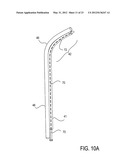 Methods of Transvascular Retrograde Access Placement and Devices for     Facilitating the Placement diagram and image