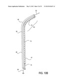 Methods of Transvascular Retrograde Access Placement and Devices for     Facilitating the Placement diagram and image